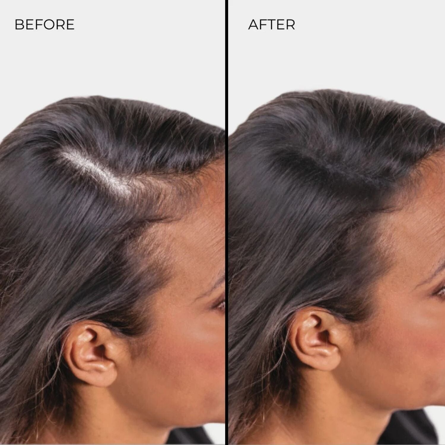 Nanogen Keratin Hair Fibres - 30g (Colour options) Hair Loss Treatments Nanogen