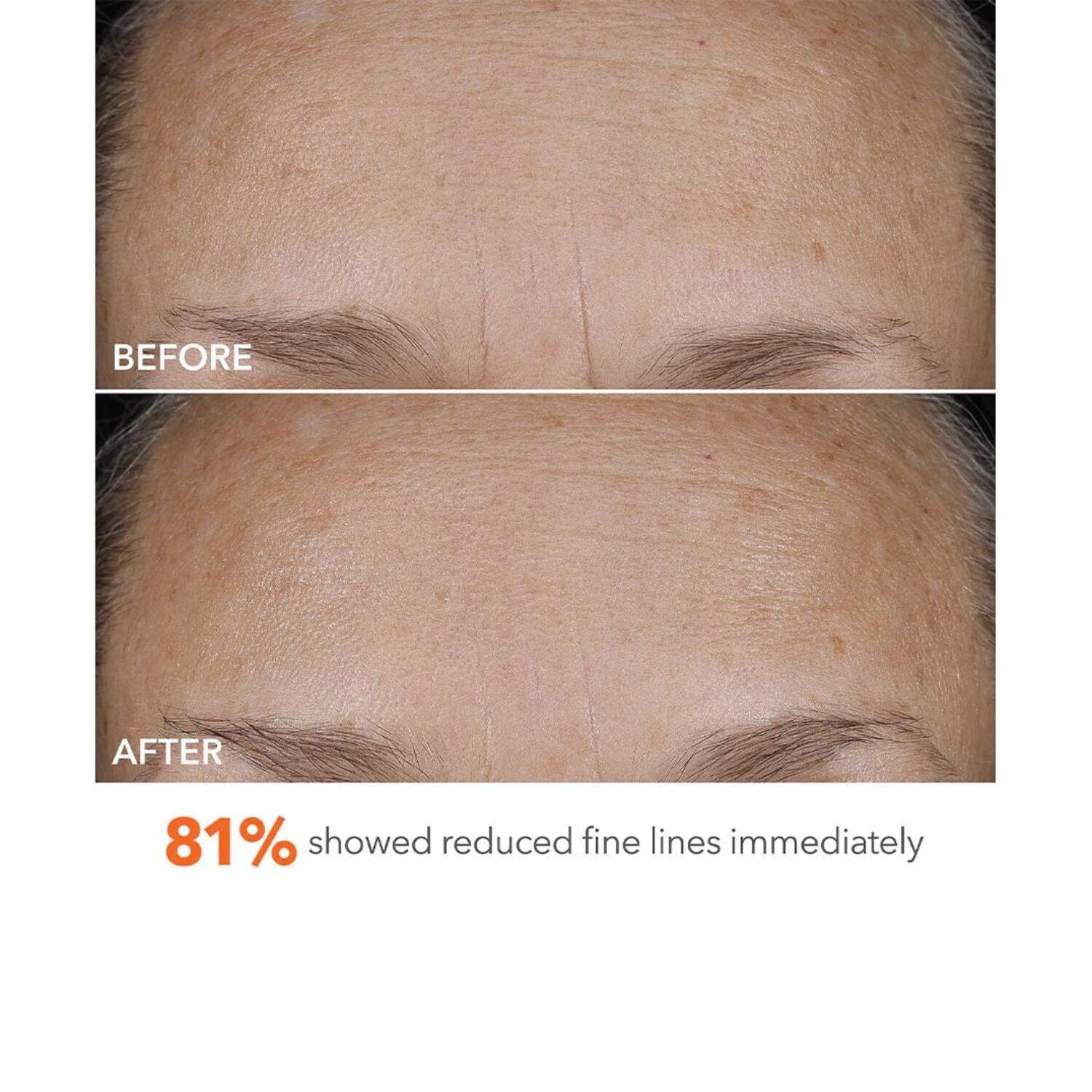 Dr. Dennis Gross Skincare Derminfusions Blur + Repair Cream (50ml) Moisturizers Dr. Dennis Gross