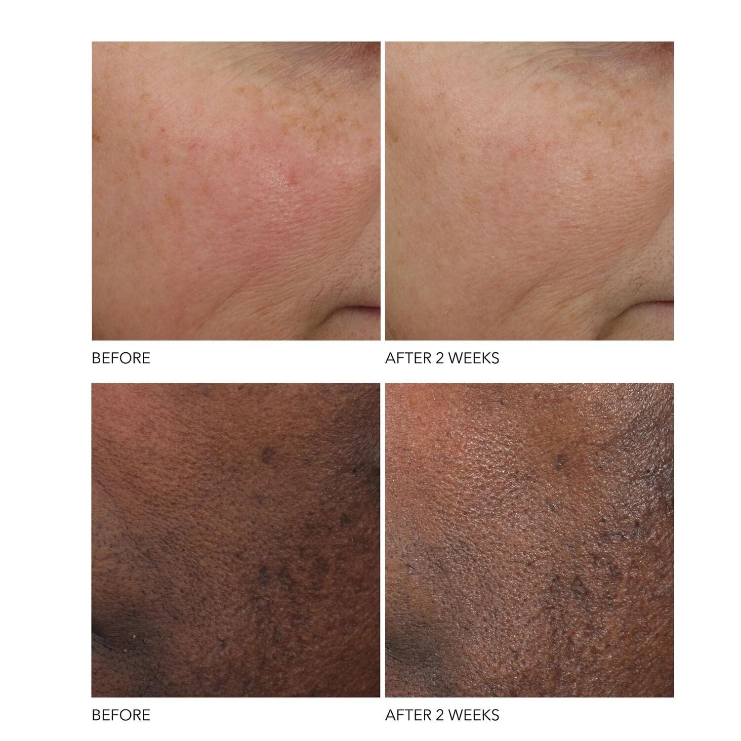Dr. Dennis Gross Skincare Advanced Retinol + Ferulic Overnight Wrinkle Treatment (30ml) Serums Dr. Dennis Gross