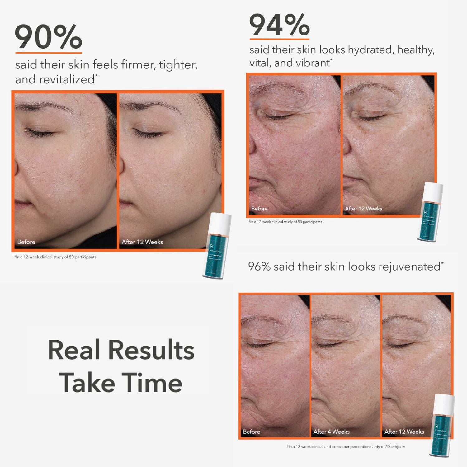 A promotional graphic showing three before-and-after skin result panels with text claiming 90%, 94%, and 96% real results over 12 weeks. Small teal and white cosmetic bottles are pictured beside the panels.