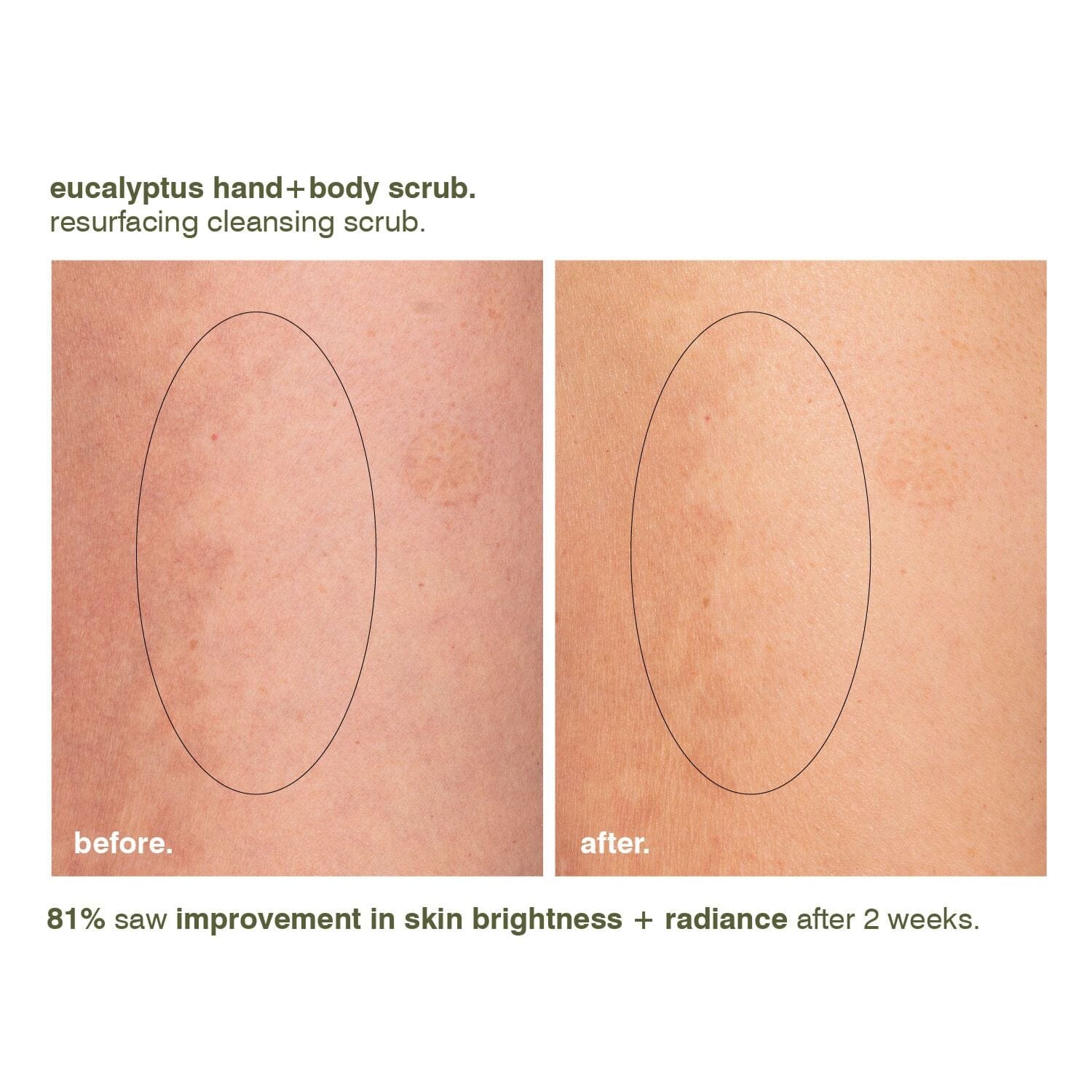 (Malin+Goetz) Eucalyptus Hand + Body Scrub (250ml) Body Scrubs (Malin+Goetz)