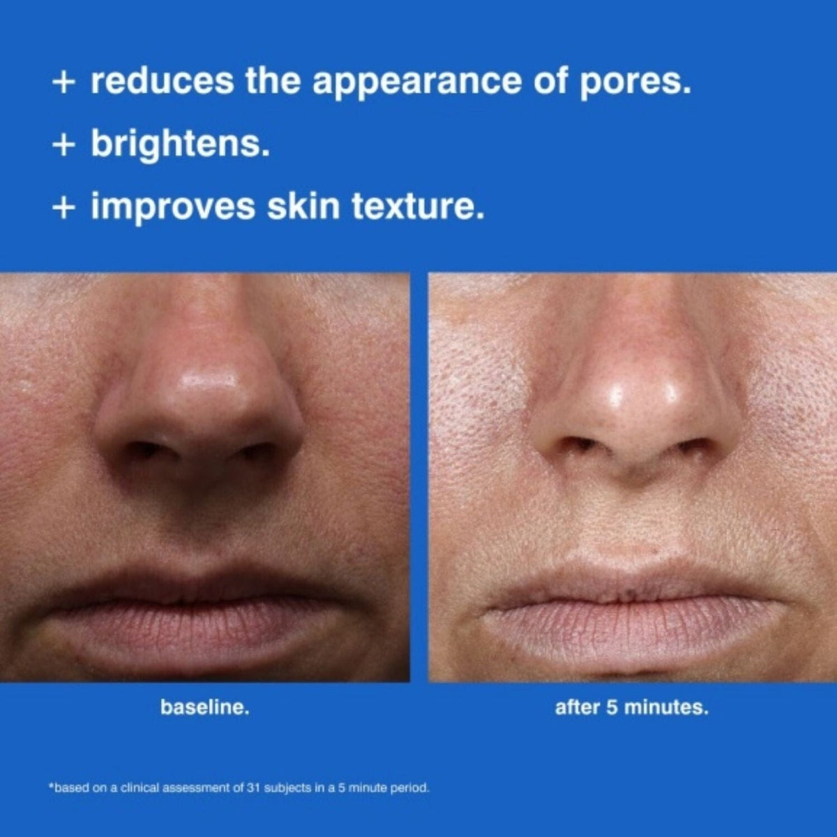 (Malin+Goetz) Foaming Reset Mask (Size Options) Masks (Malin+Goetz)