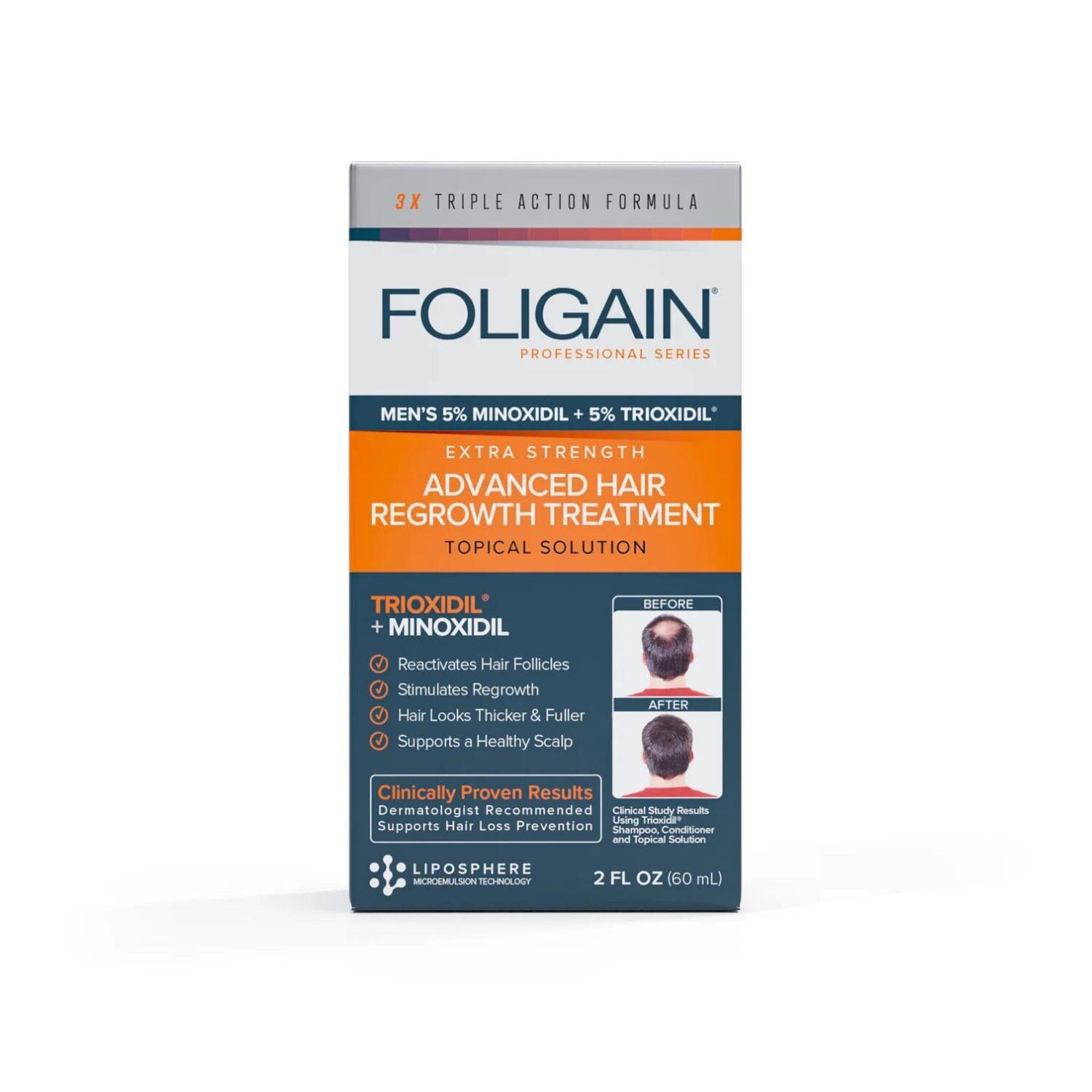 Foligain Advanced Hair Regrowth Treatment For Men with 5% Minoxidil & 5% Trioxidil (59ml) Hair Loss Treatments Foligain