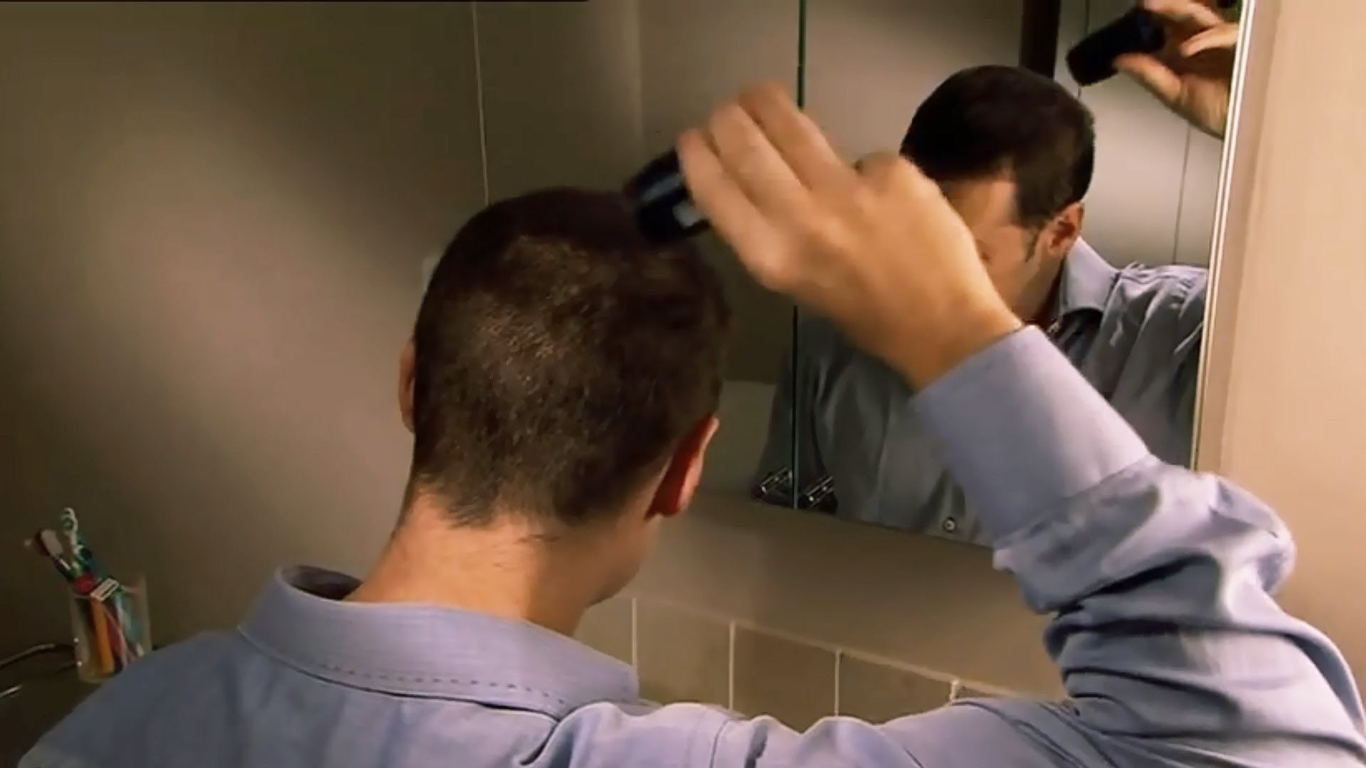 Hair Loss / Thickening