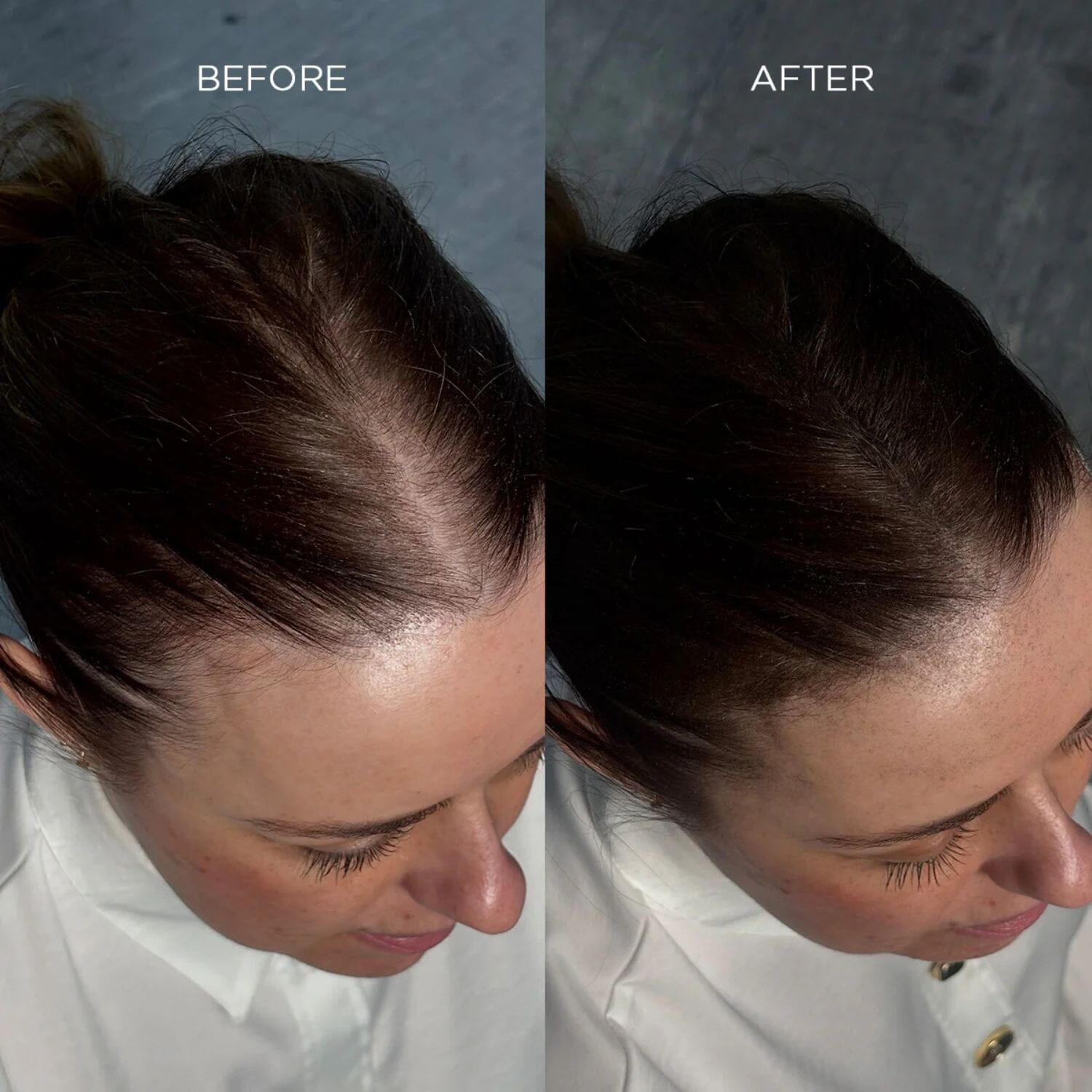 Nanogen Keratin Hair Fibres - 30g (Colour options) Hair Loss Treatments Nanogen 