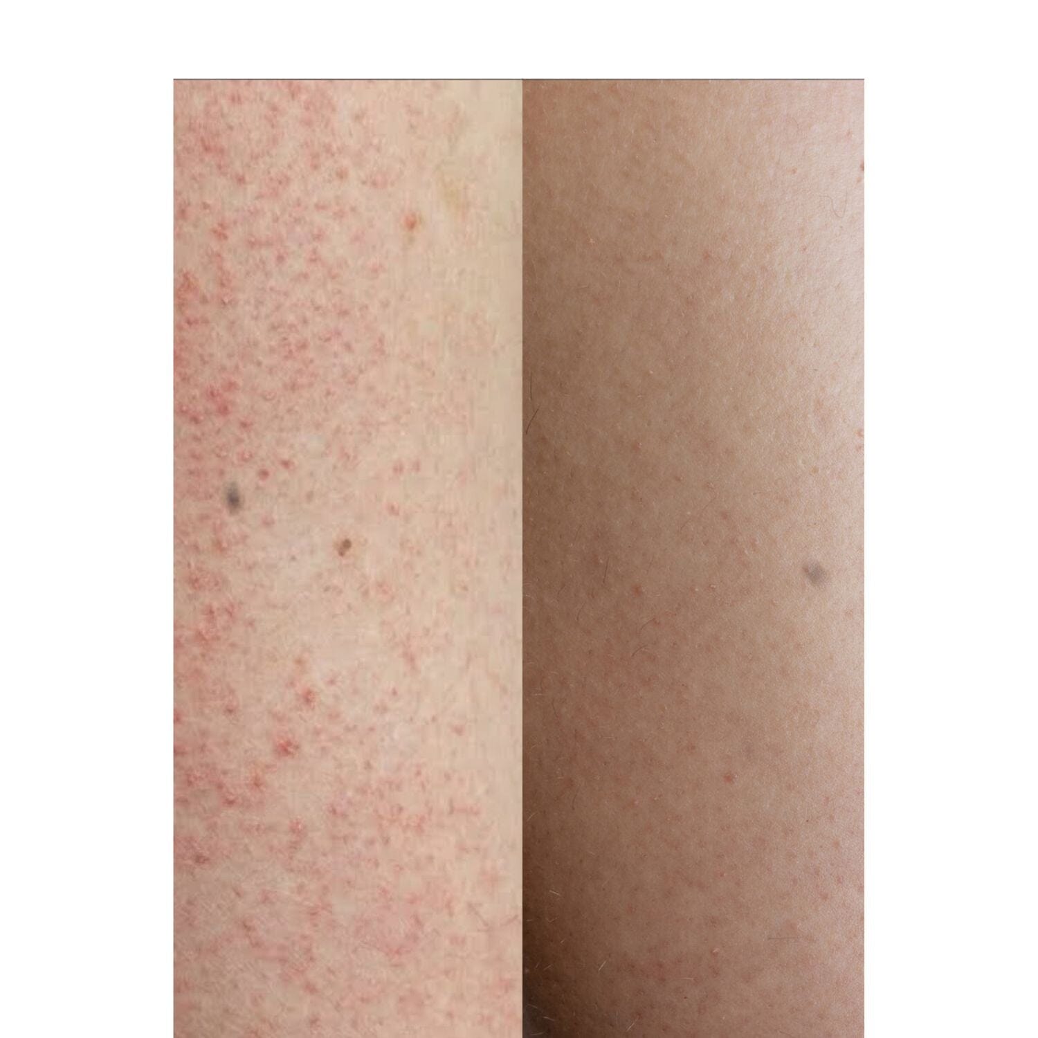 Grown Alchemist Resurfacing Targeted Body Cleanser (300ml) Shower Gels & Washes Grown Alchemist 