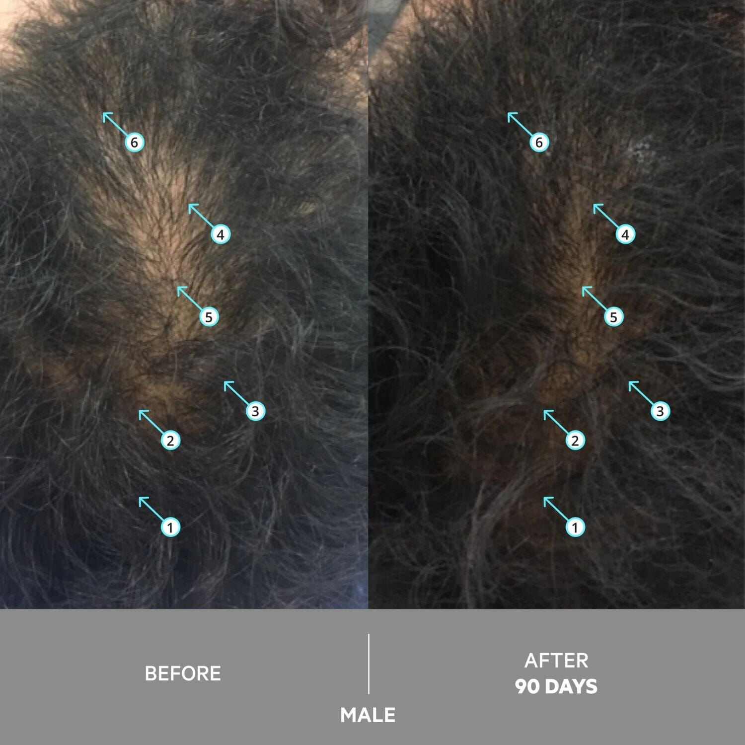 DS Laboratories Spectral Extra Strength Anti-Gray Hair Density Serum (60ml) Grey Hair Solutions DS Laboratories 