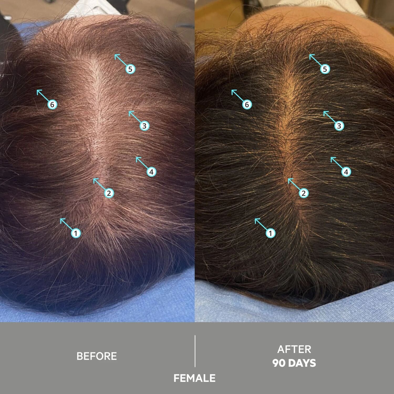 DS Laboratories Spectral Extra Strength Anti-Gray Hair Density Serum (60ml) Grey Hair Solutions DS Laboratories 