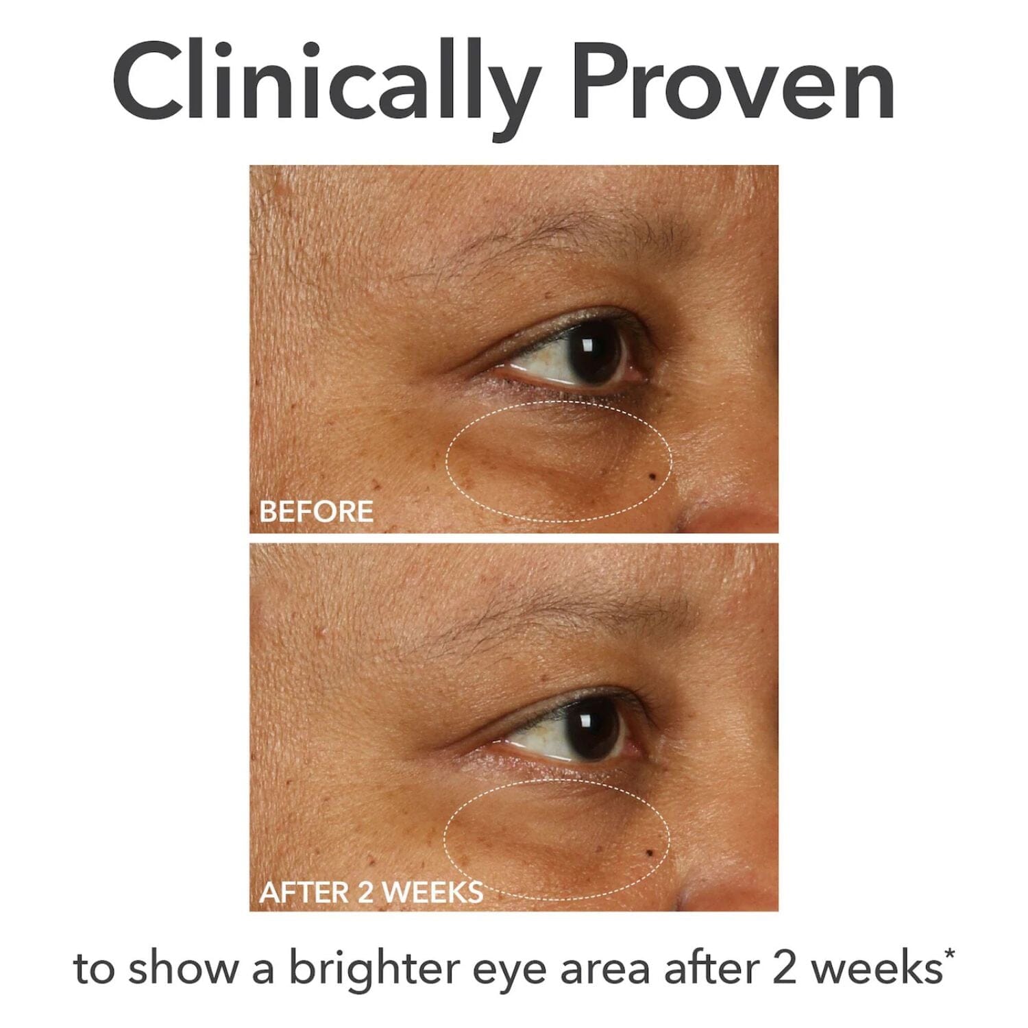 Dr. Dennis Gross DermInfusions Fill + Repair Eye Cream (15ml) Undereye Dr. Dennis Gross 