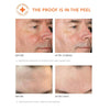 Dr. Dennis Gross Skincare Extra Strength Alpha Beta Peel (30-60 treatments) Pads & Peels Dr. Dennis Gross 