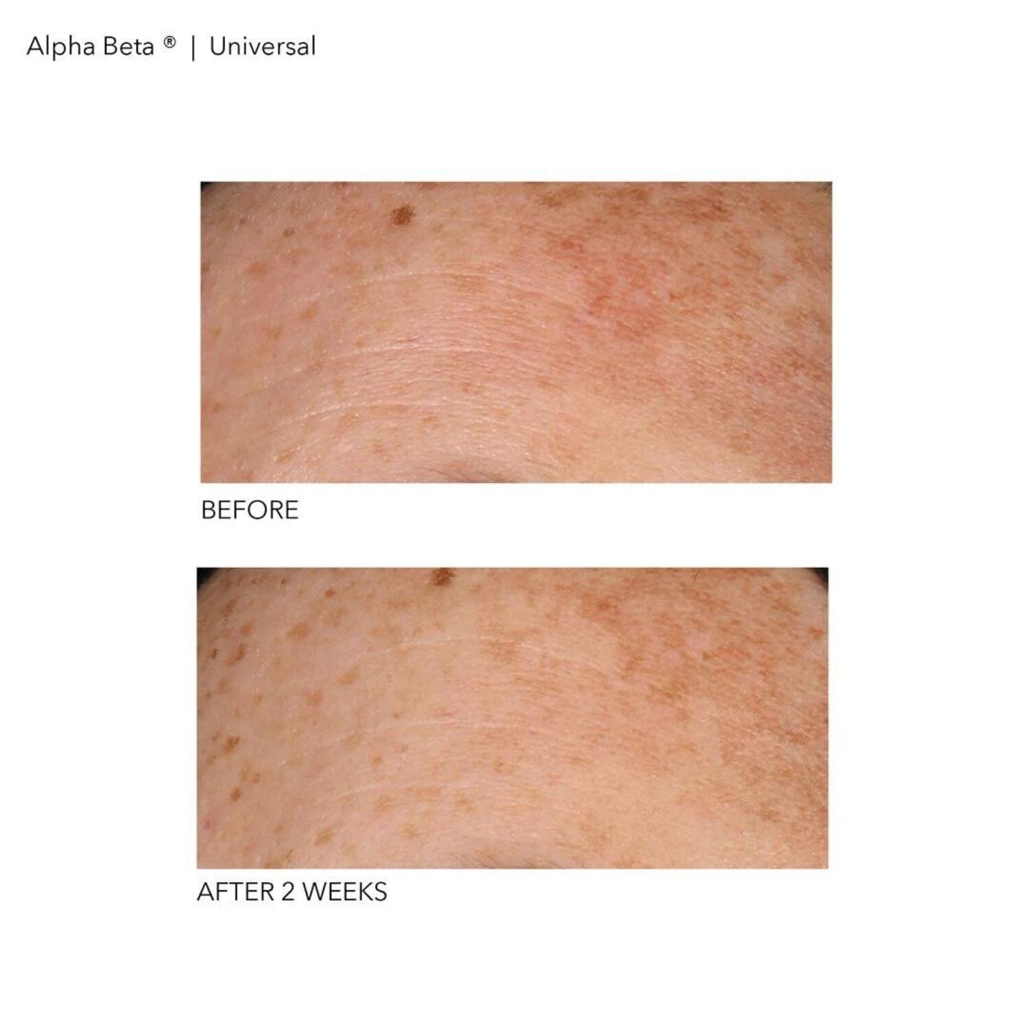 Dr. Dennis Gross Skincare Alpha Beta Universal Daily Peel (30-60 treatments) Pads & Peels Dr. Dennis Gross 