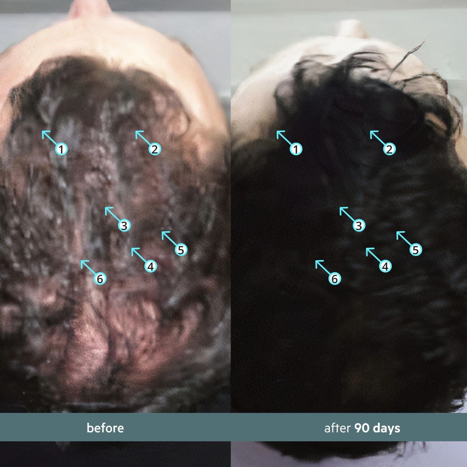 DS Laboratories Spectral Booster - Stress Adaptogen Serum (60ml) Hair Loss Treatments DS Laboratories 