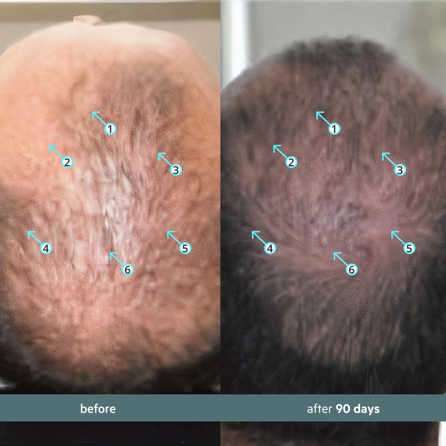 DS Laboratories Spectral Booster - Stress Adaptogen Serum (60ml) Hair Loss Treatments DS Laboratories 