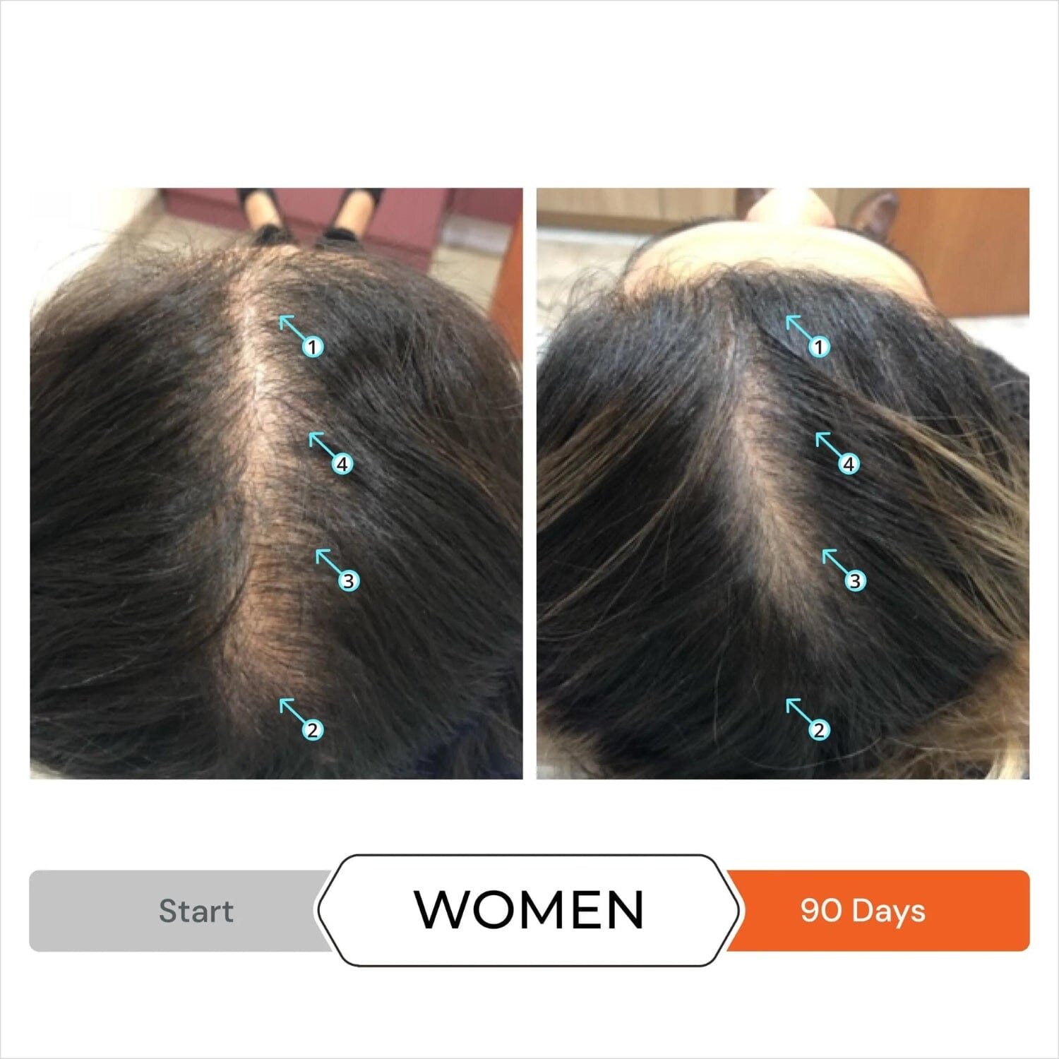 DS Laboratories Revita Hair Growth Support Gummies (60ct) Supplements DS Laboratories 