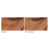 Dr. Dennis Gross Skincare Advanced Retinol + Ferulic Overnight Texture Renewal Peel (16 treatments) Pads & Peels Dr. Dennis Gross 